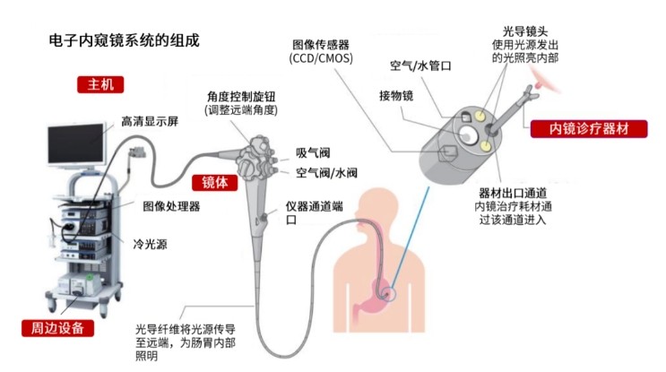 電子內(nèi)窺鏡系統(tǒng)的組成