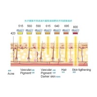 五大光子嫩膚技術(shù)（IPL、DPL、OPT、APT、BBL）及濾光片區(qū)別